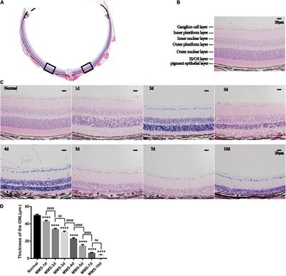 Rapamycin Improved Retinal Function and Morphology in a Mouse Model of Retinal Degeneration